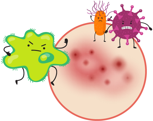 細菌|感染|馬拉色菌